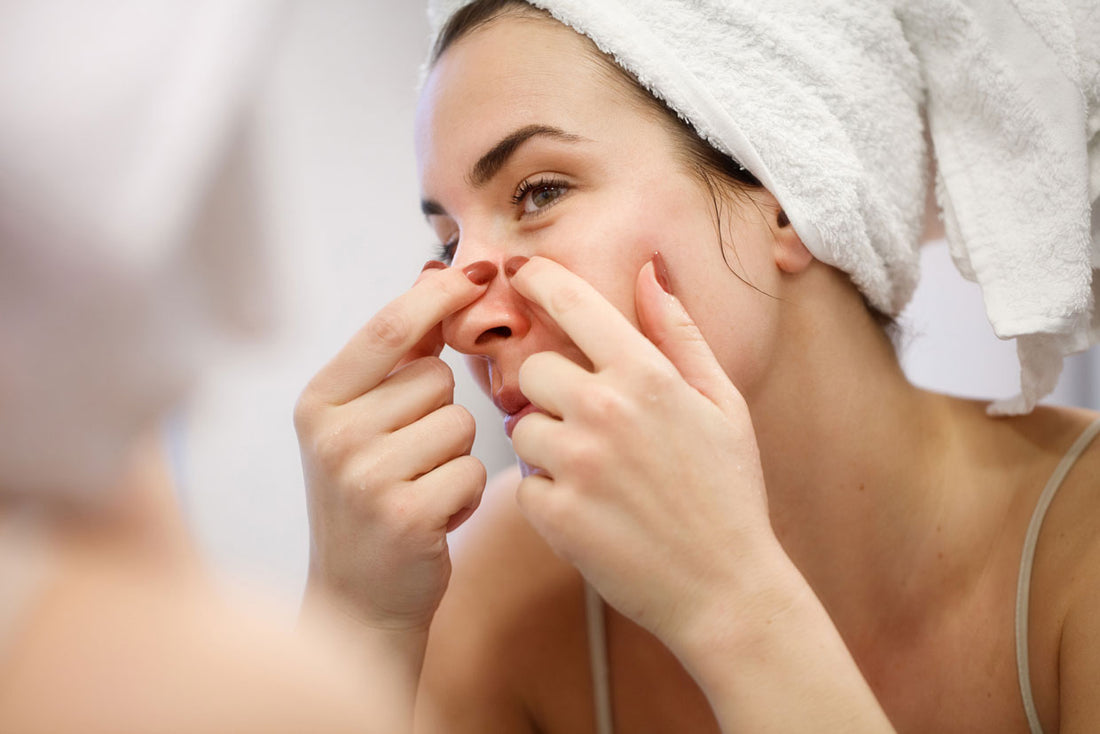 Picking At Your Skin “ Dermatillomania “
