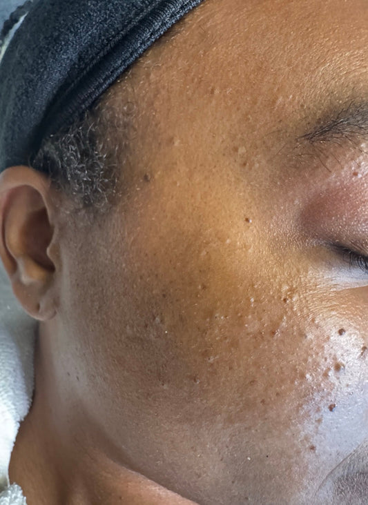 APPOINTMENT TO YOUR FLAWLESS SKIN